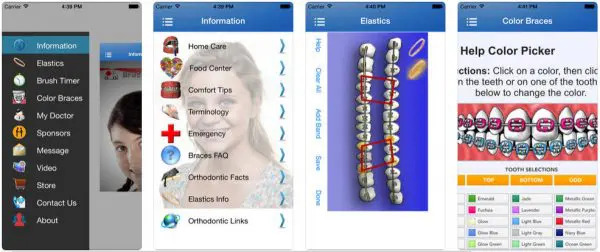 Braces Help Braces Help